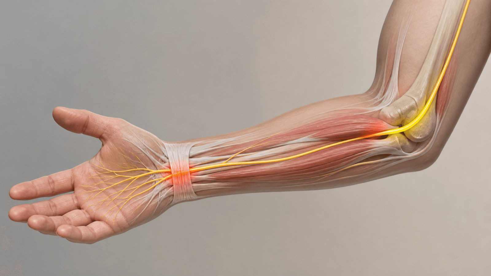 Arm illustration highlighting median nerve and ulnar nerve regions